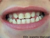 A close up of a person 's mouth showing their teeth.