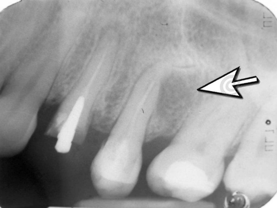 Radiografia dentale