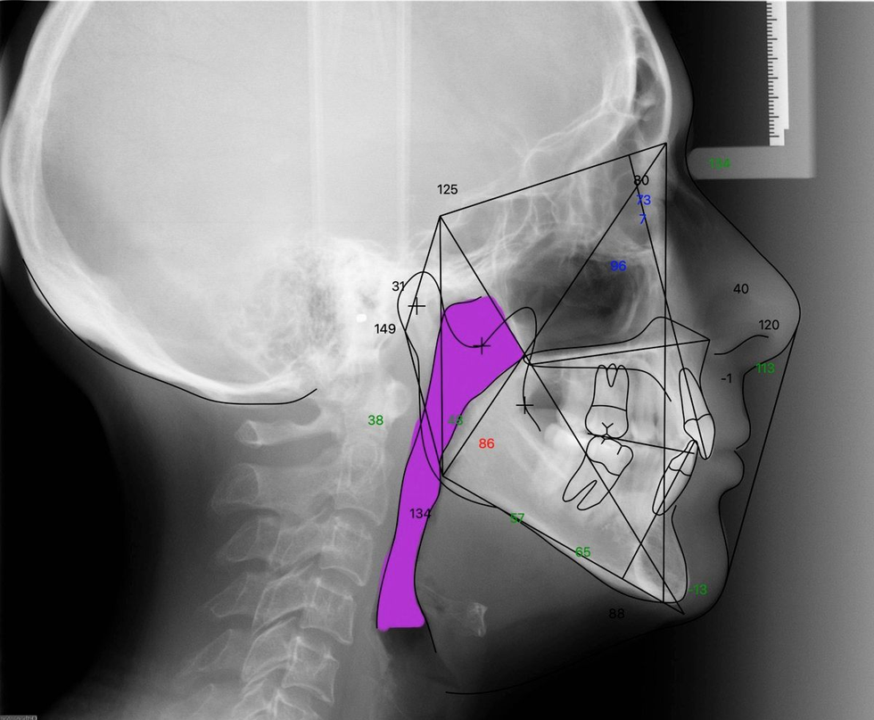 Doctor reviewing early treatment options for orthodontics