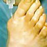 A close-up of a needle being injected into the joint of a foot.