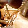 Close-up of a medical procedure showing gloved hands performing surgery on exposed tissue with a surgical instrument.