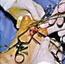Medical professionals in gloves use surgical instruments to perform a procedure on a patient's hand.