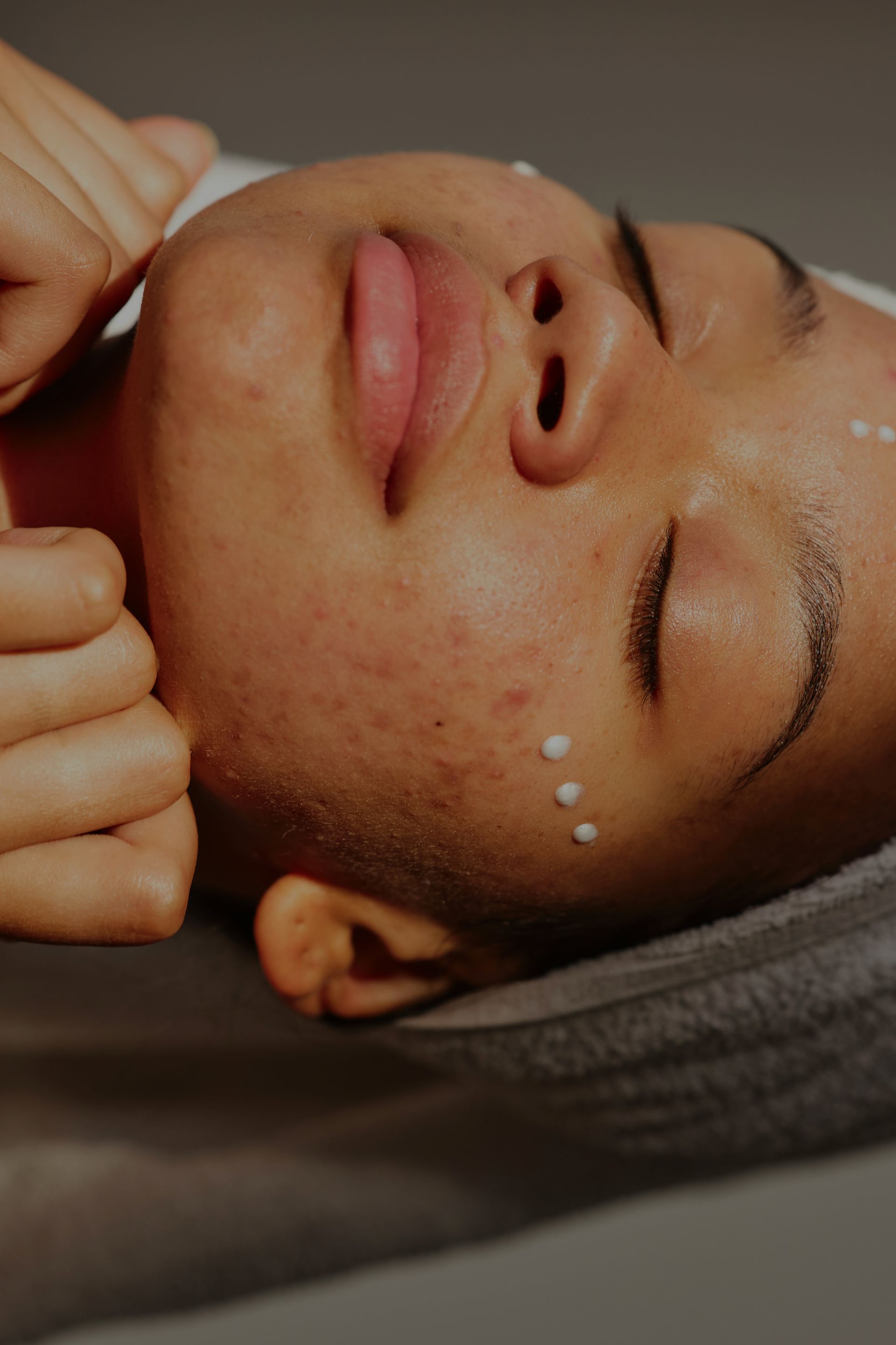 Person receiving facial treatment, with dots of product on the face.