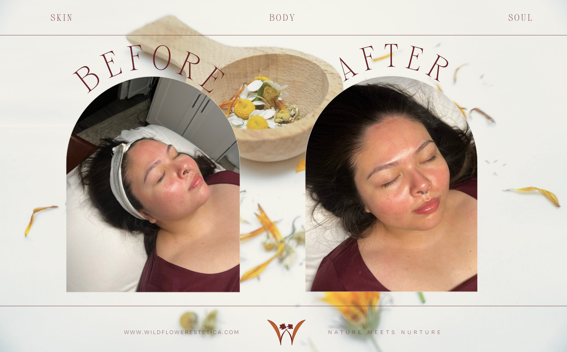 BEFORE AND AFTER DERMAPLANING. A WOMAN LAYING BACK WITH GLOWING SKIN.
