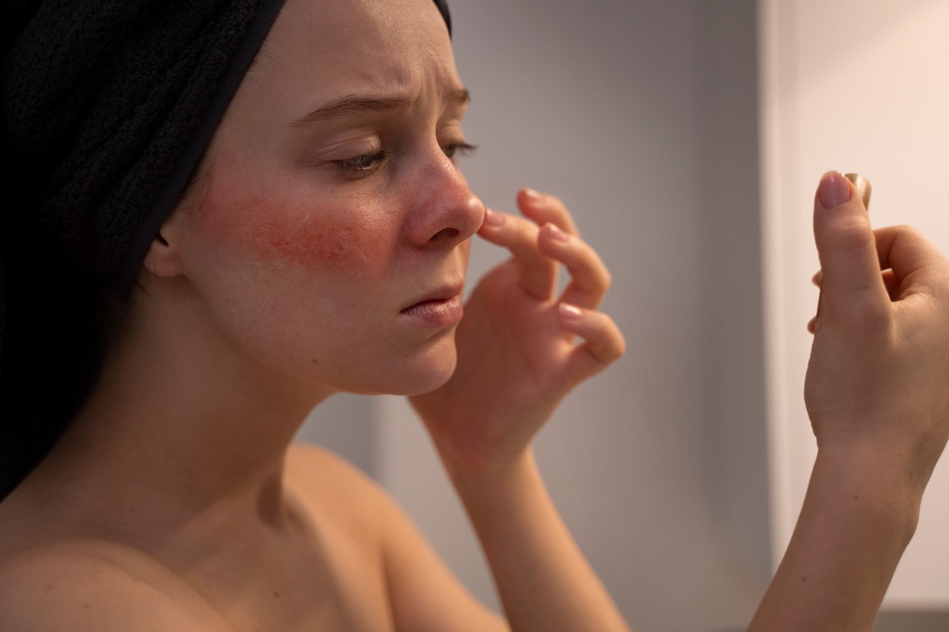Person with a towel on head applies cream to a red cheek while looking in a mirror