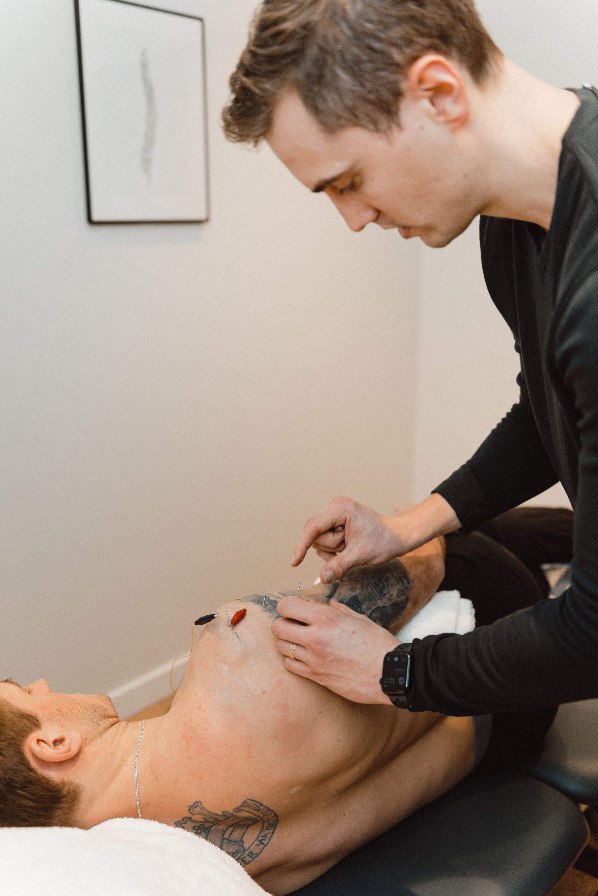 acupuncture being performed on patient