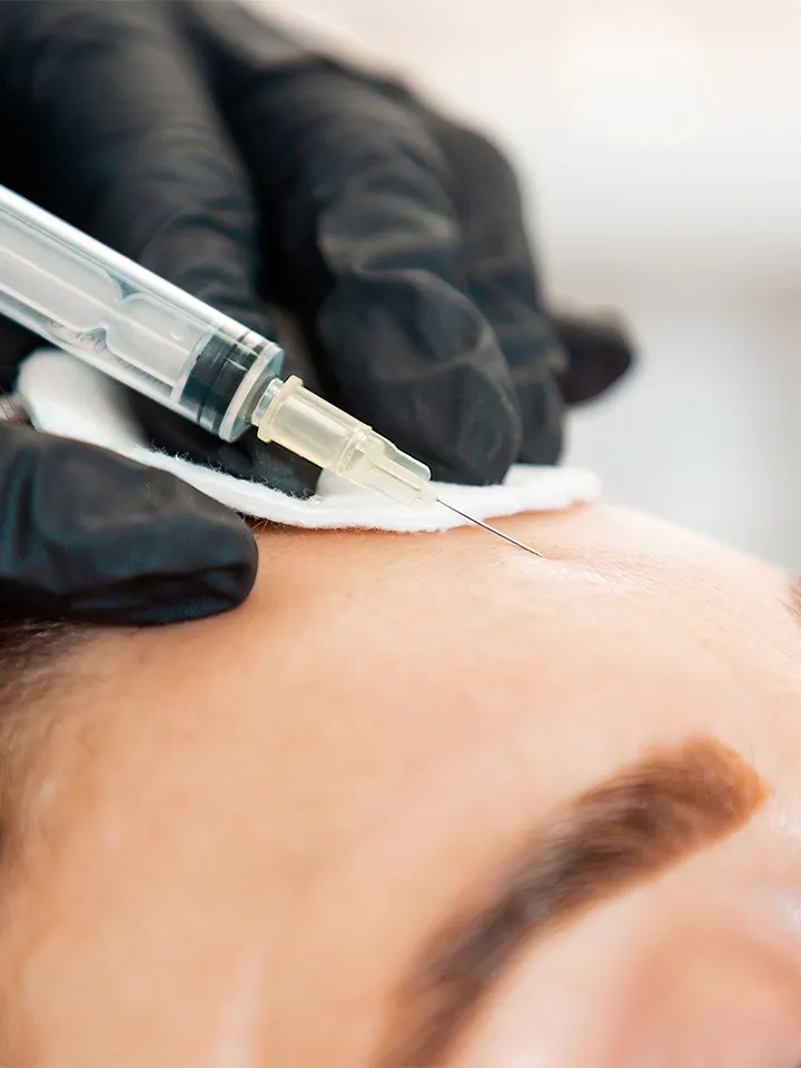 Gloved hands using a syringe on a person’s forehead during a cosmetic skin treatment