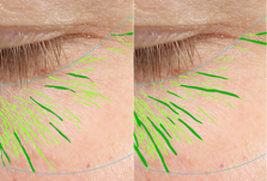 A close up of a person 's eye with green lines on it.