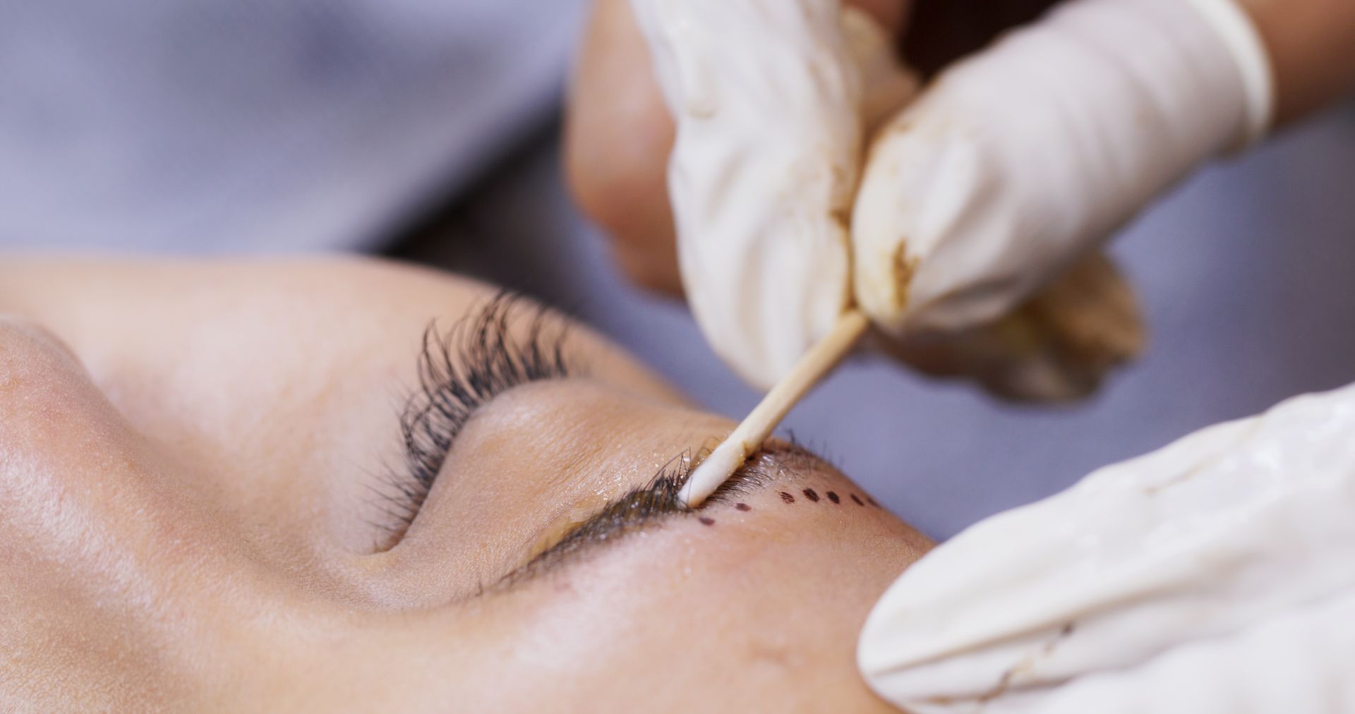 Facelift Procedure