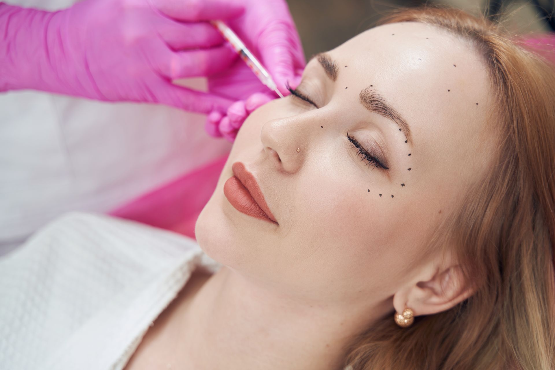 Facelift Procedure