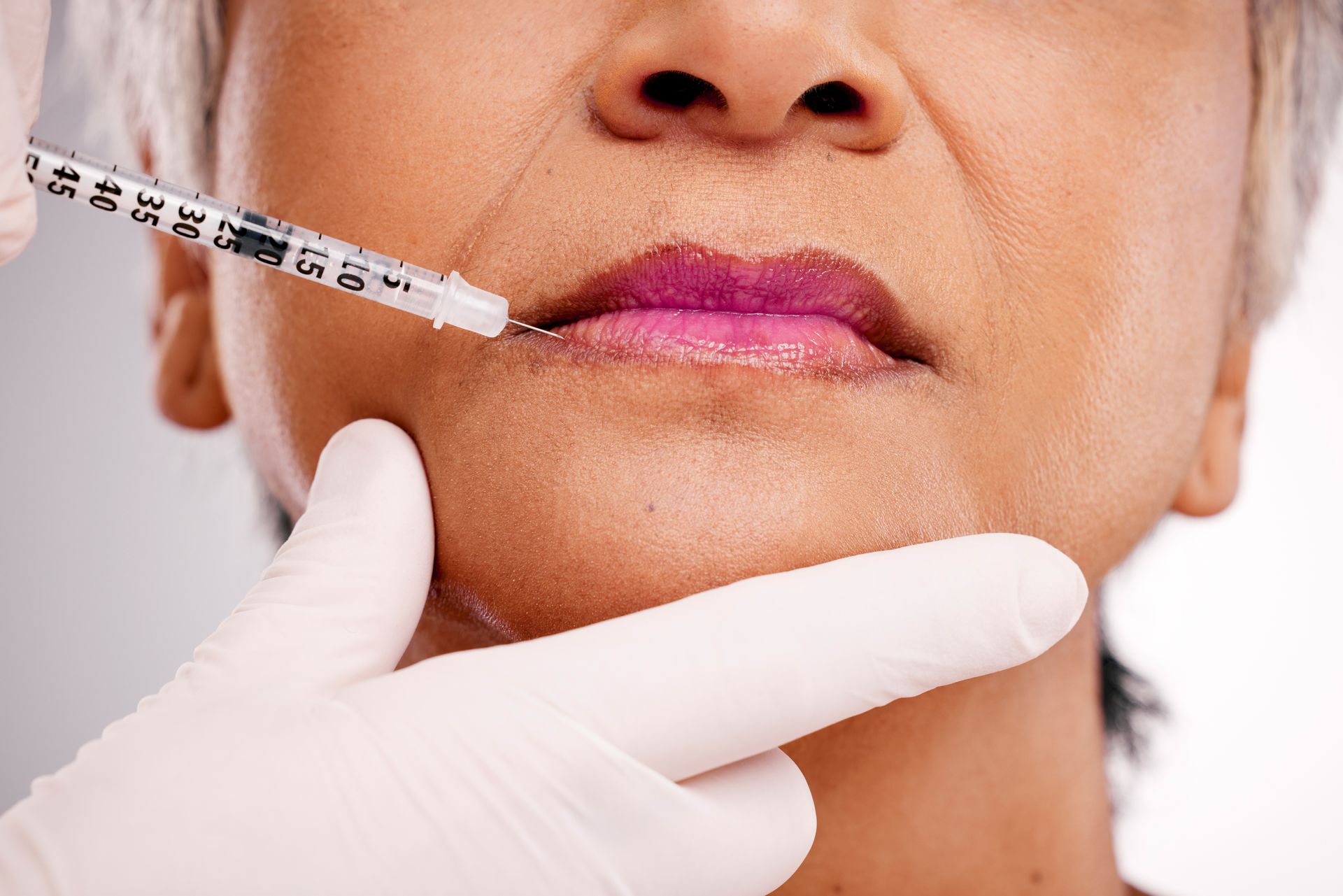 Facelift Procedure
