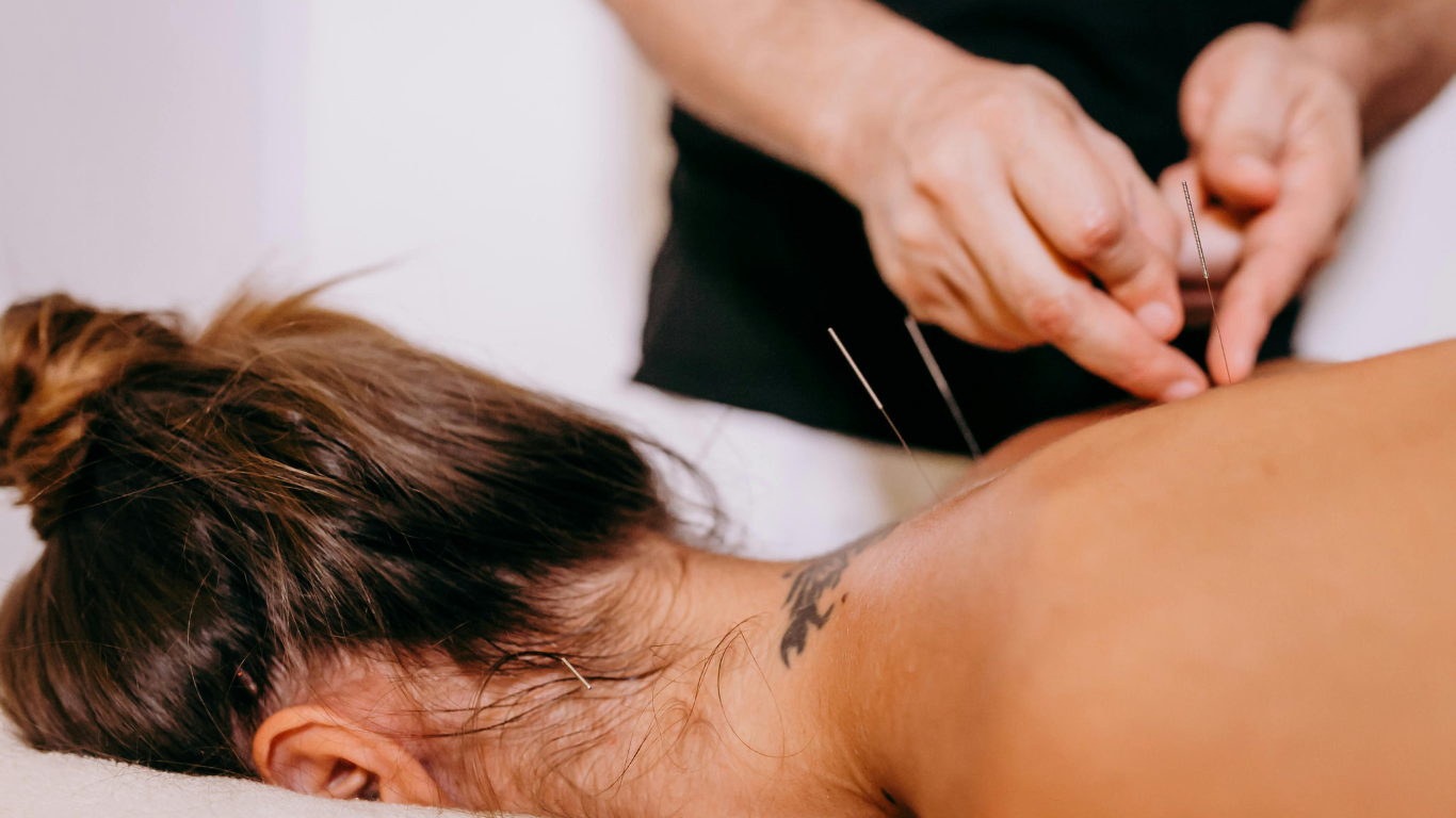 Acupuncturist inserting needles into a person’s back, setting is a treatment room.