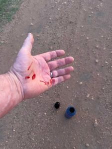 Hand with multiple small, fresh cuts, lying on a dirt surface near a black cap and blue tube.