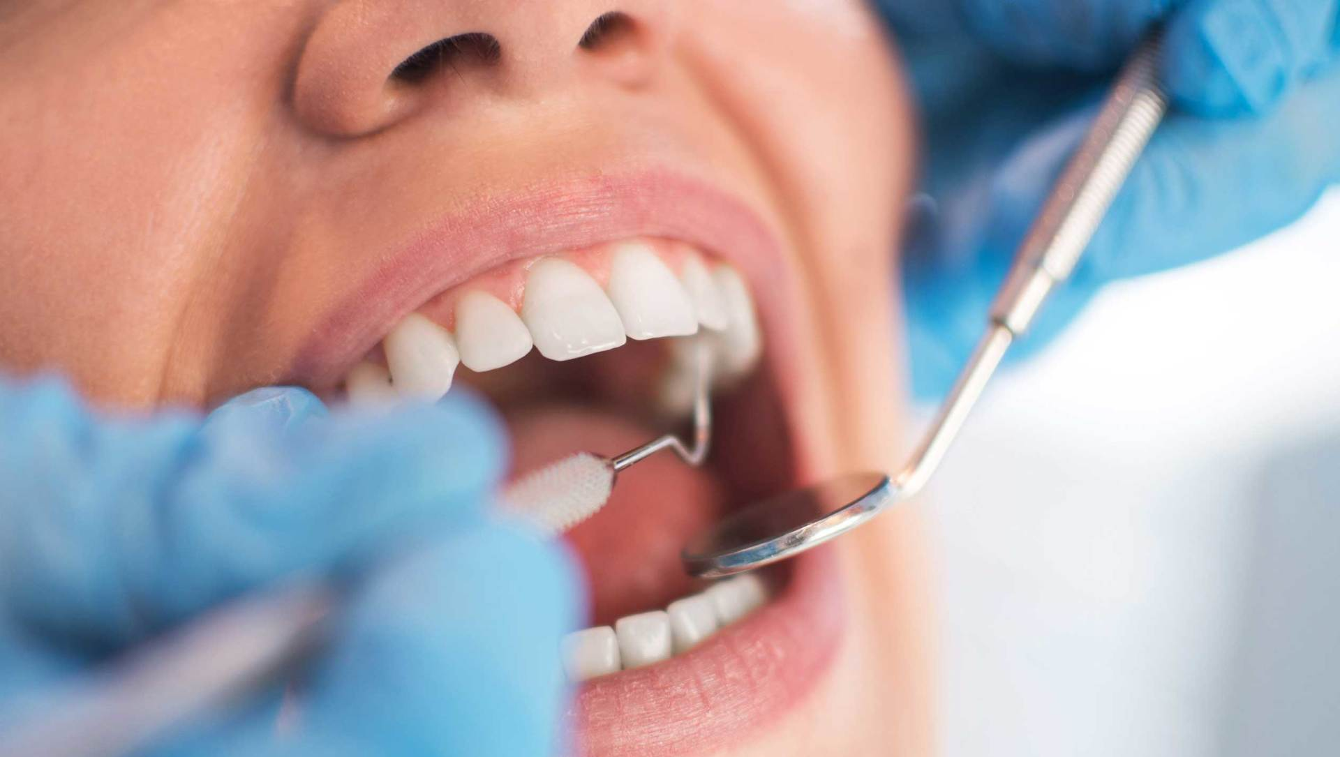 Dentiste ganté examinant la bouche d’une patiente avec un miroir et une sonde dentaire.