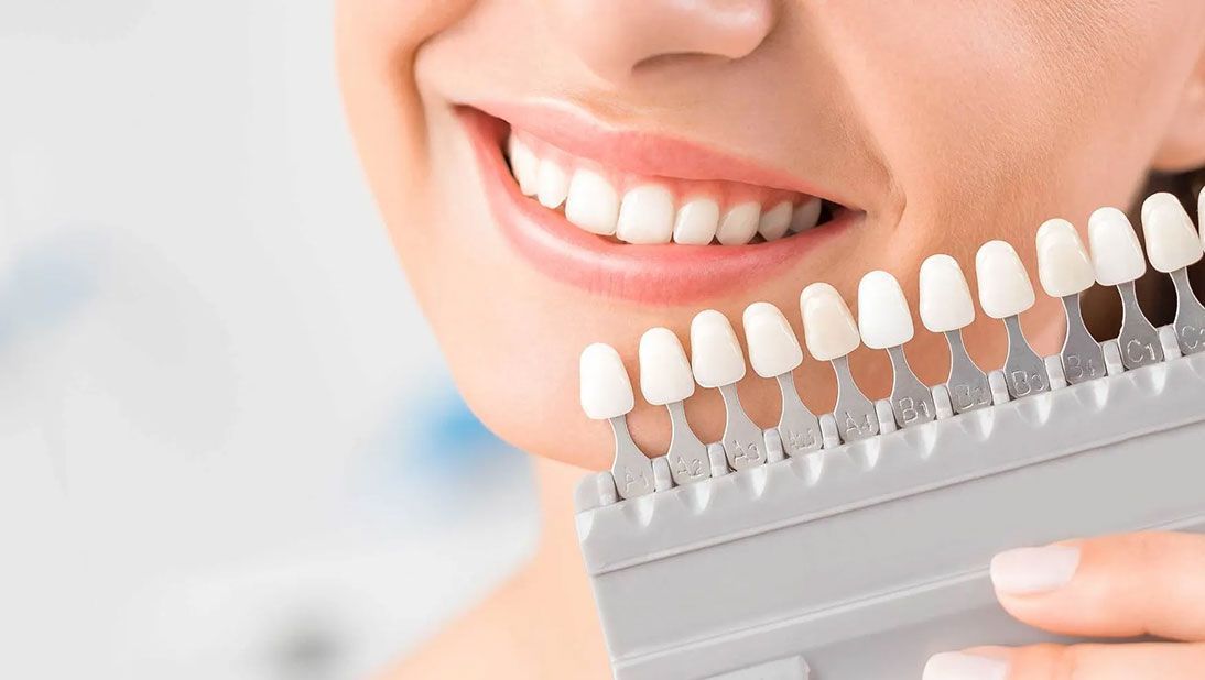 tooth molding and measurement tool