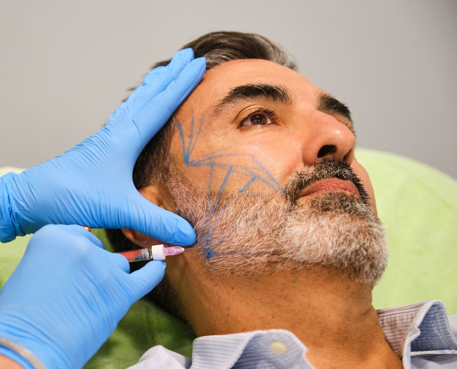 A woman is getting a botox injection in her lips.