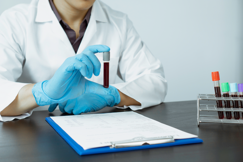 Blood Test