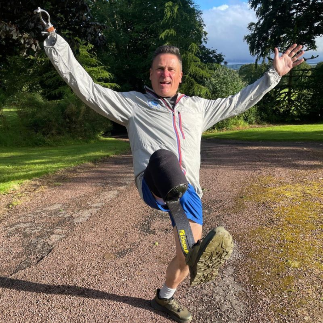 Happy smiling man with prosthetic hook and prosthetic leg