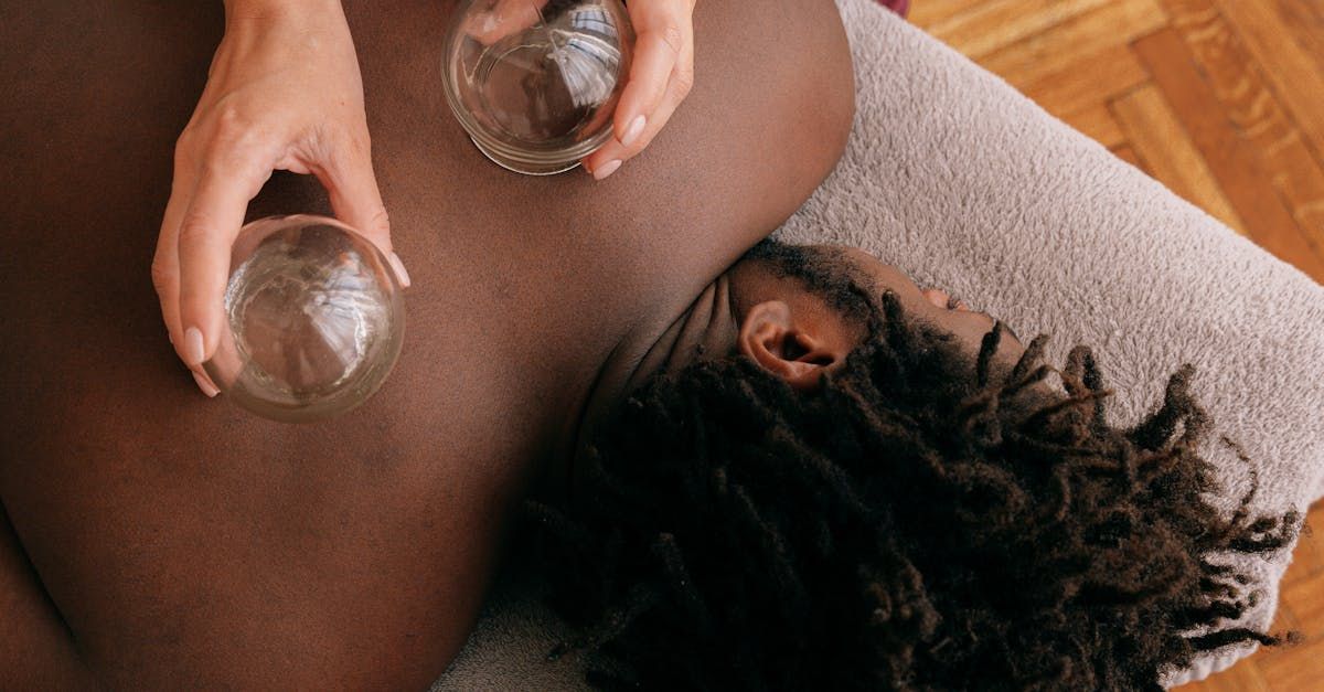 cupping