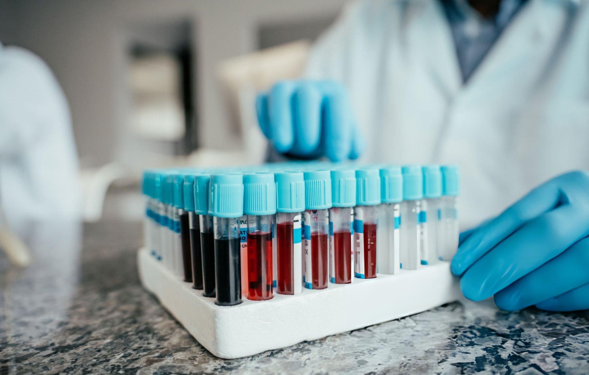 Analyses et prélèvements au laboratoire