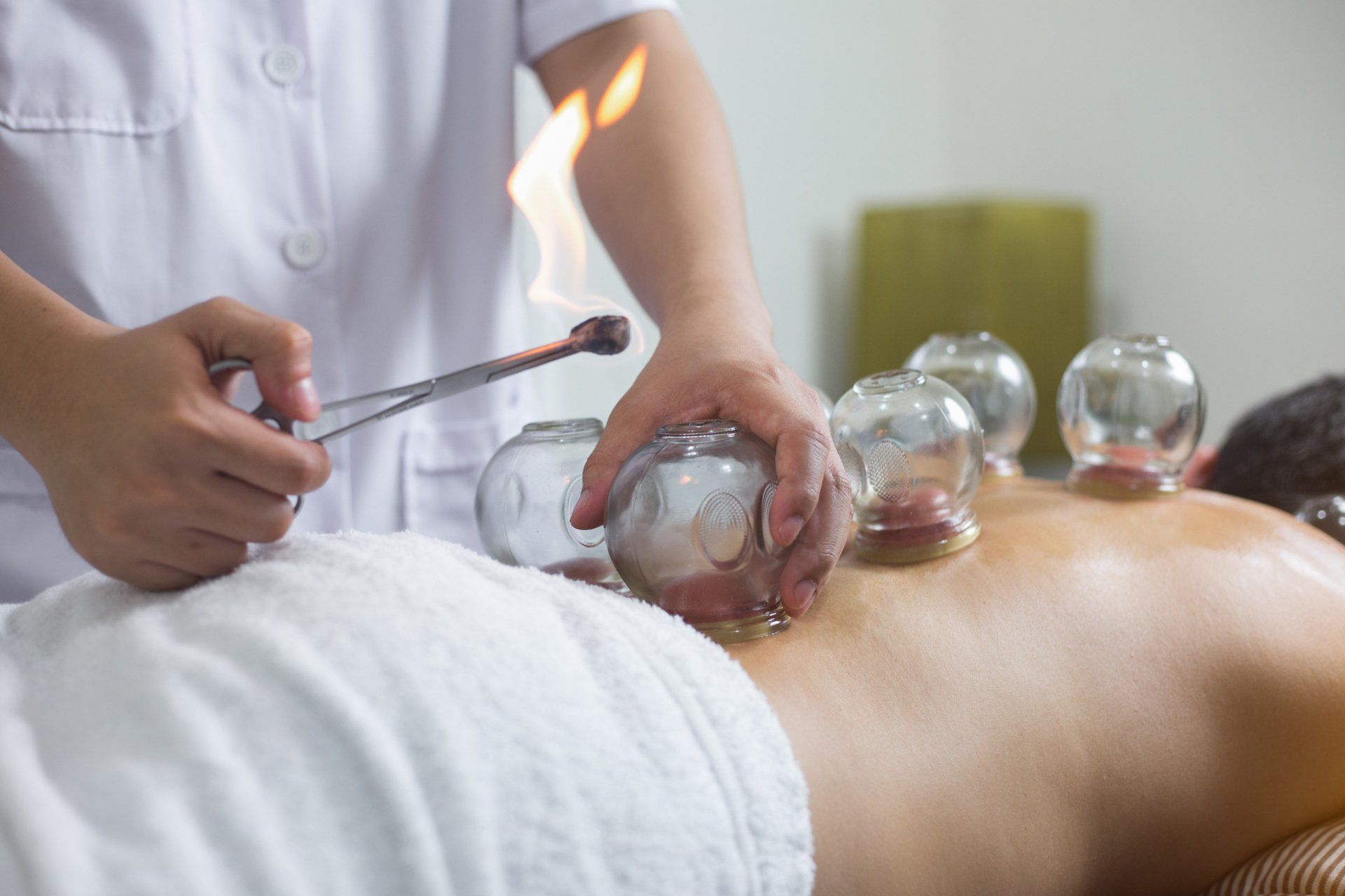 Cupping Massage - Chambersburg, PA - Alison Wengert Licensed Massage Therapy