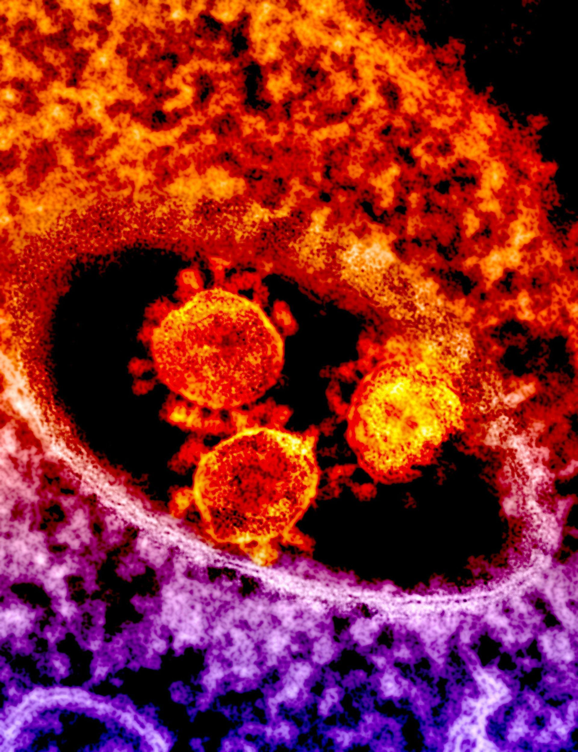 Three orange, spherical viruses within a purple and red biological cell.