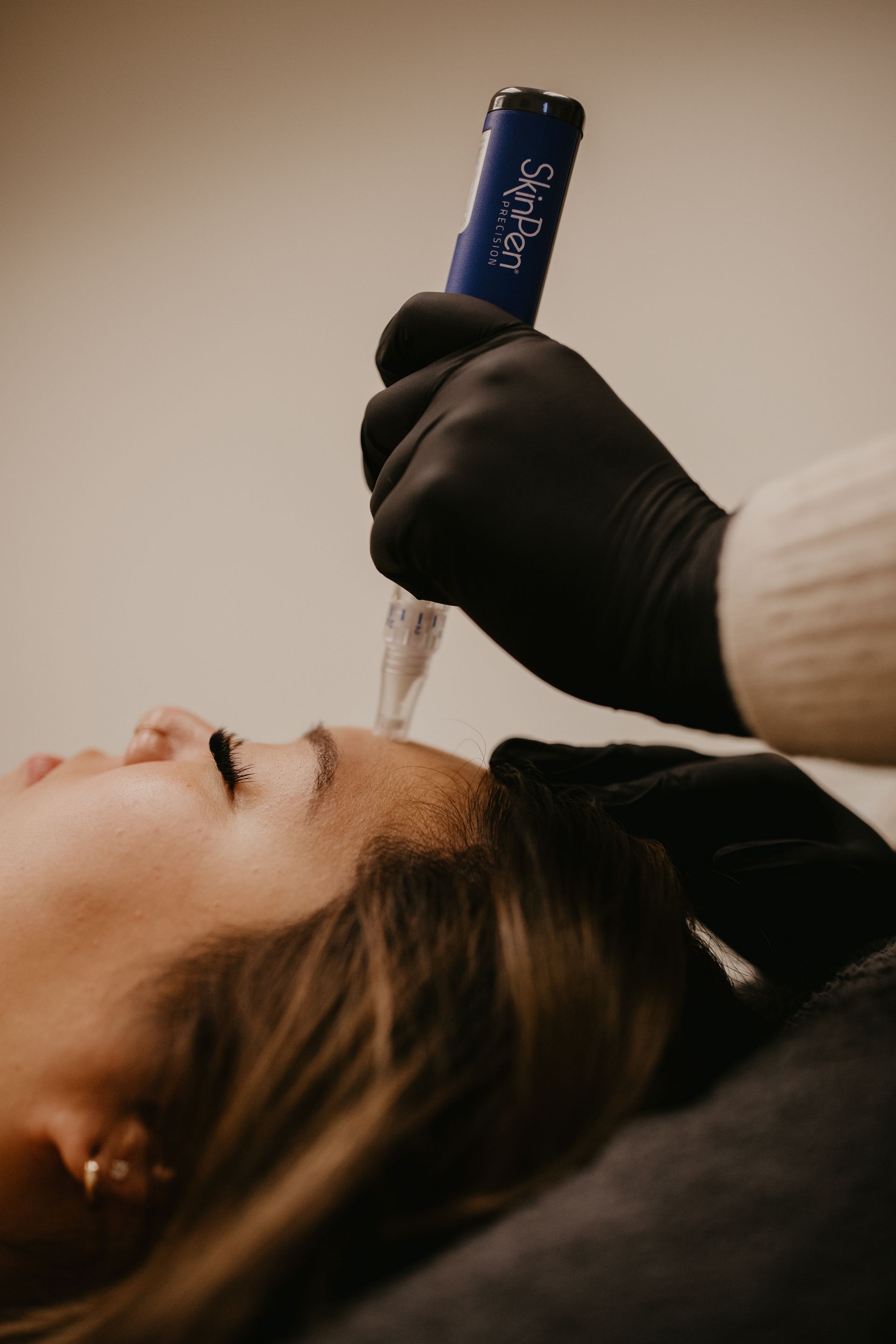 A close-up of a gloved hand using a microneedling device on a person’s forehead during a skincare treatment.
