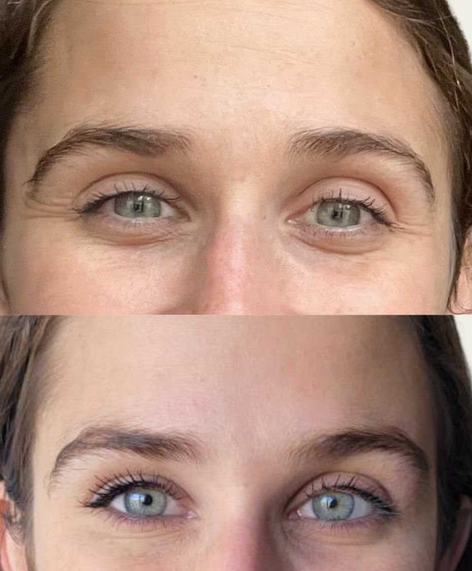 A before and after picture of a woman 's face with green eyes.