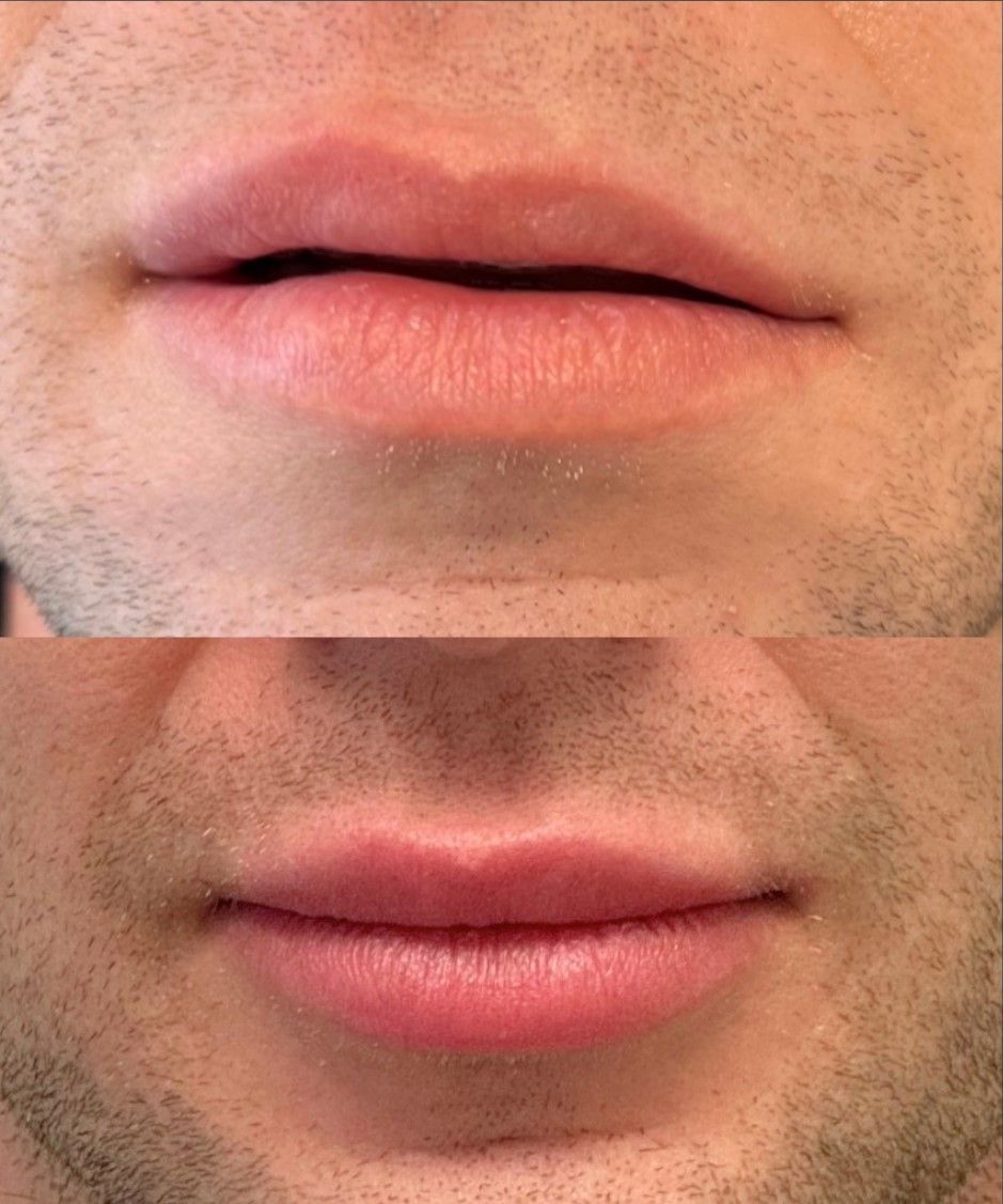 A before and after picture of a man 's lips.