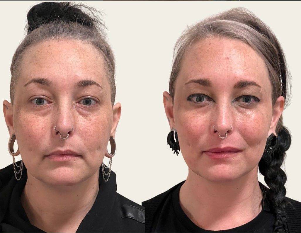 A before and after photo of a woman 's face.