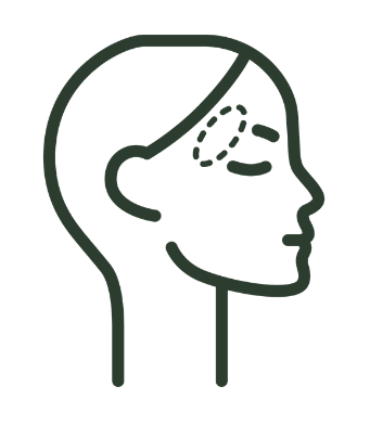 Line-art side profile of a head with dotted marks around the eye area, suggesting cosmetic or medical treatment