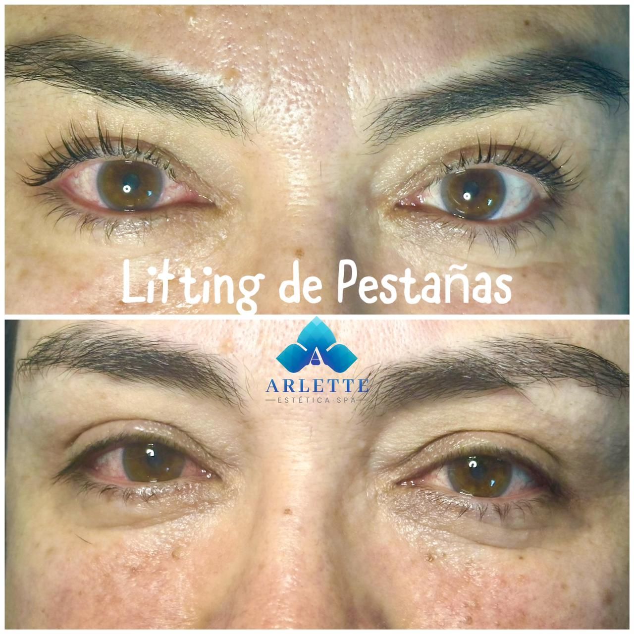 Estética y Spa en Mexicali