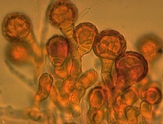 Orange-brown microscopic view of clustered round cells with thick, textured outer walls