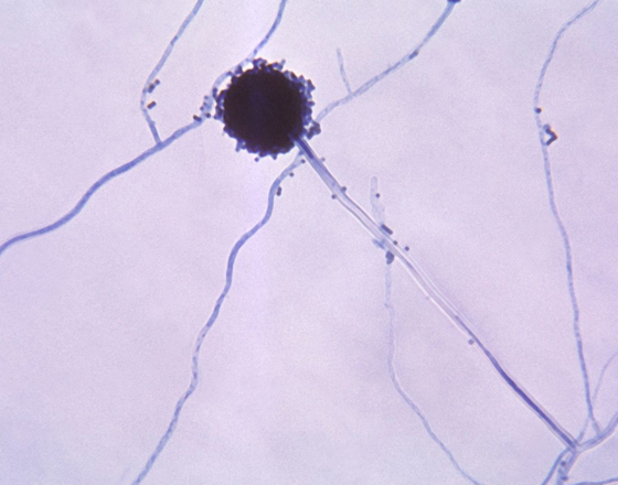 Dark spiky fungal colony with blue branching filaments on a pale background