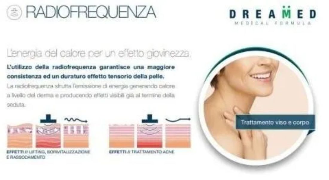 Locandina radiofrequenza