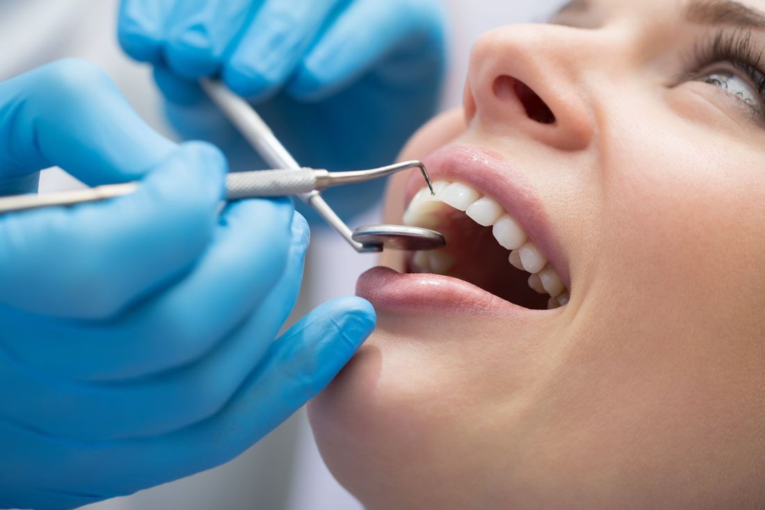 Pulizia dentale