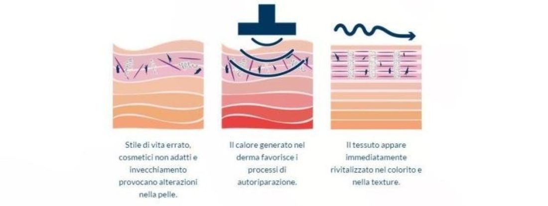 Spiegazione effetto lifting