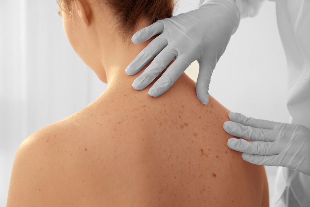 A Woman is Getting Her Skin Examined by a Doctor — Mount Archer Medical Centre in Berserker, QLD