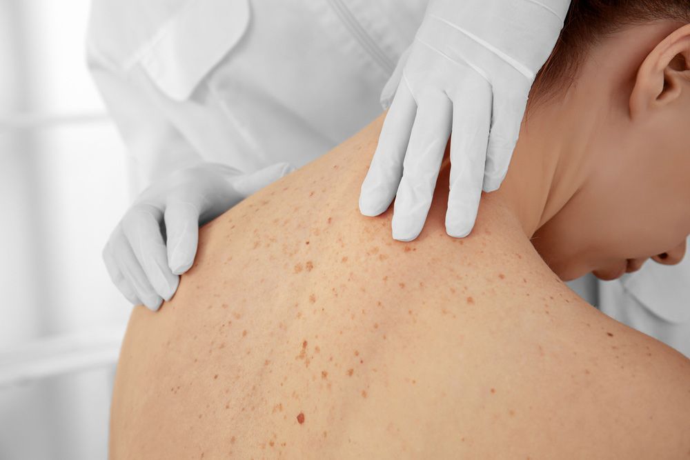 A Woman is Getting Her Back Examined by a Doctor — Mount Archer Medical Centre in Berserker, QLD