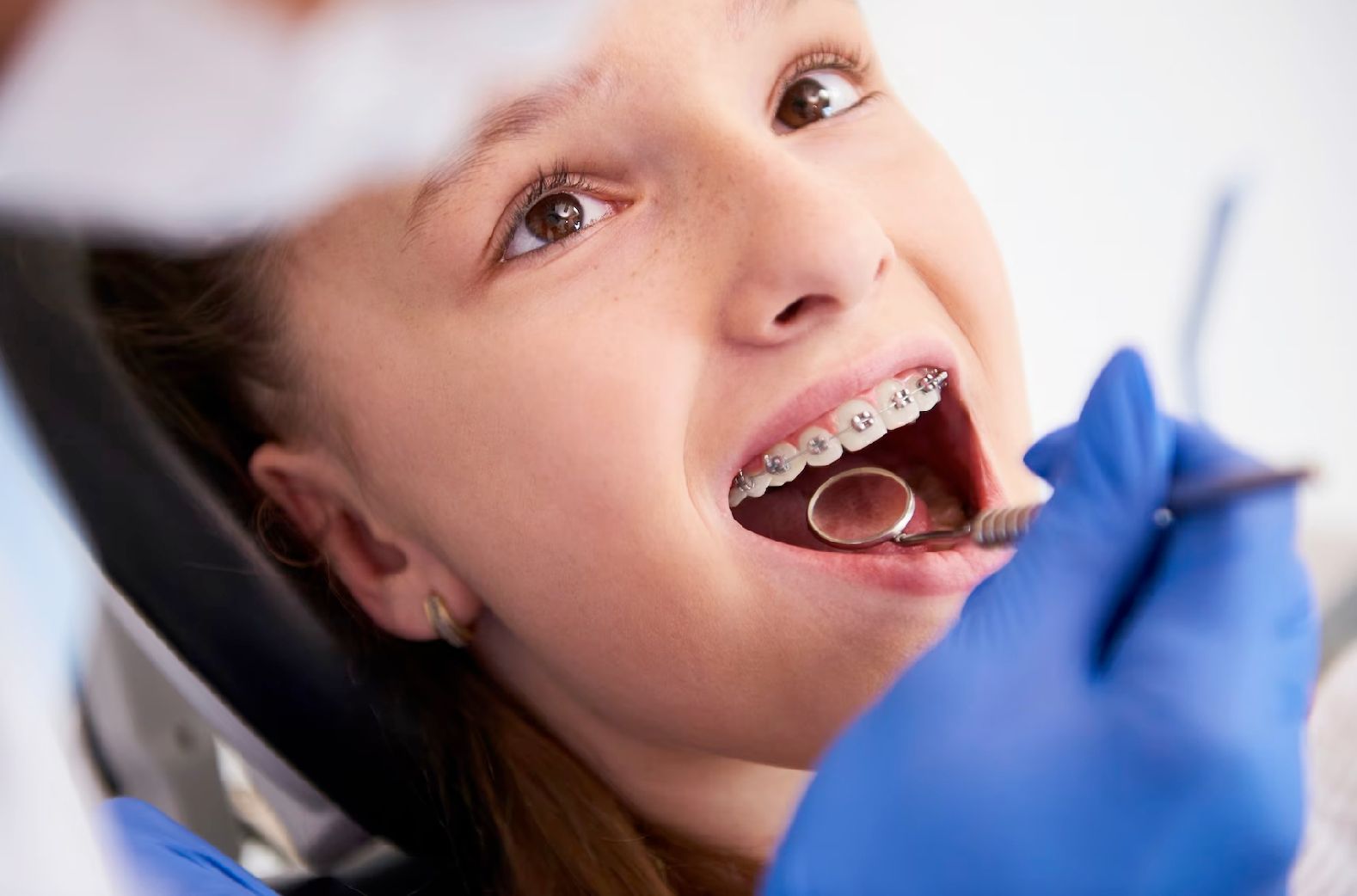 A young girl with braces is getting her teeth examined by a dentist.