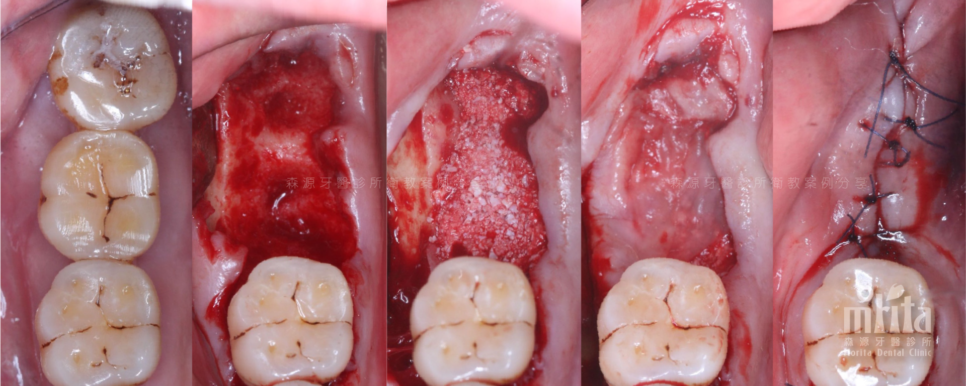 Teeth