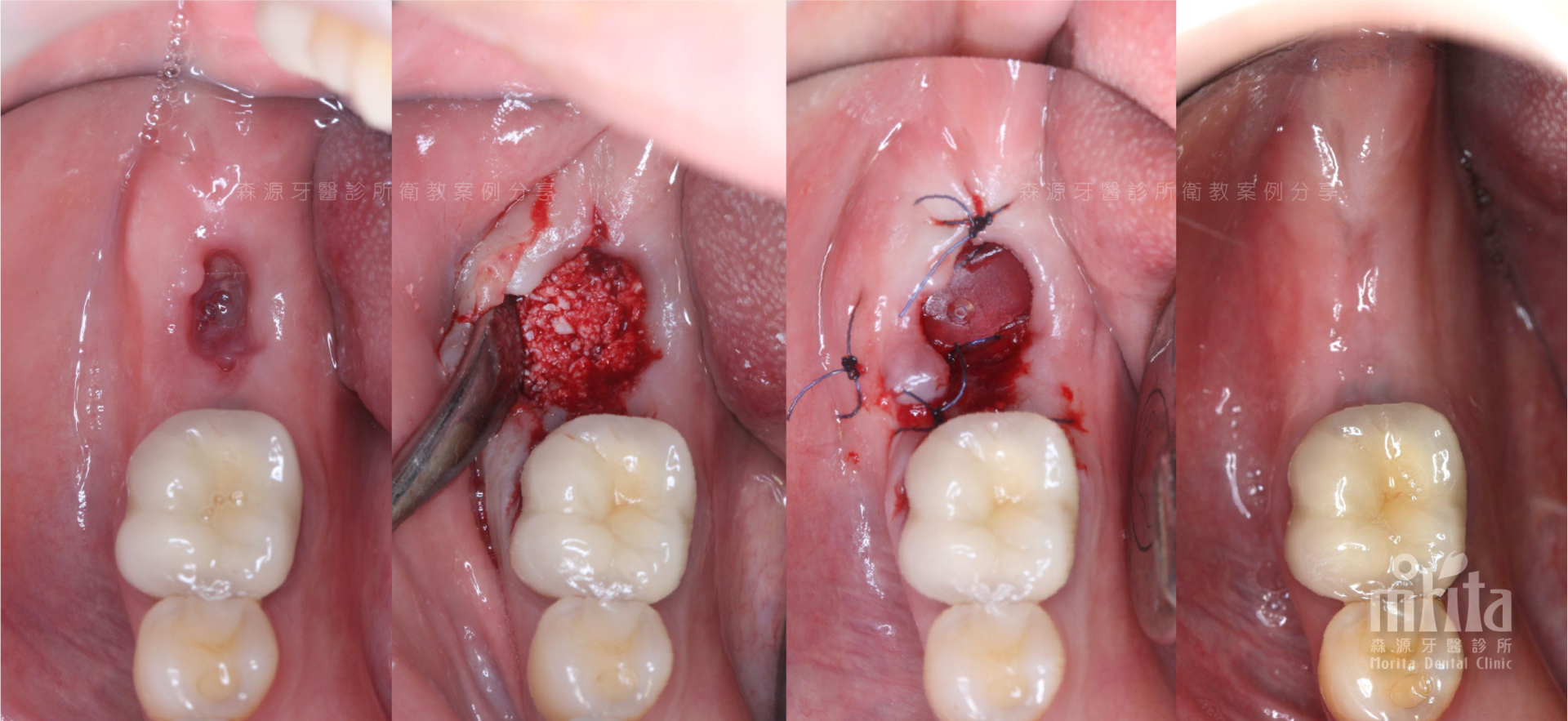 Teeth
