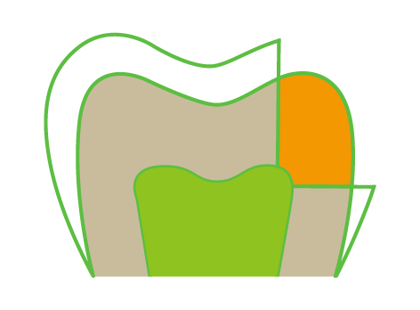 A drawing of a tooth with a green tooth and an orange tooth.