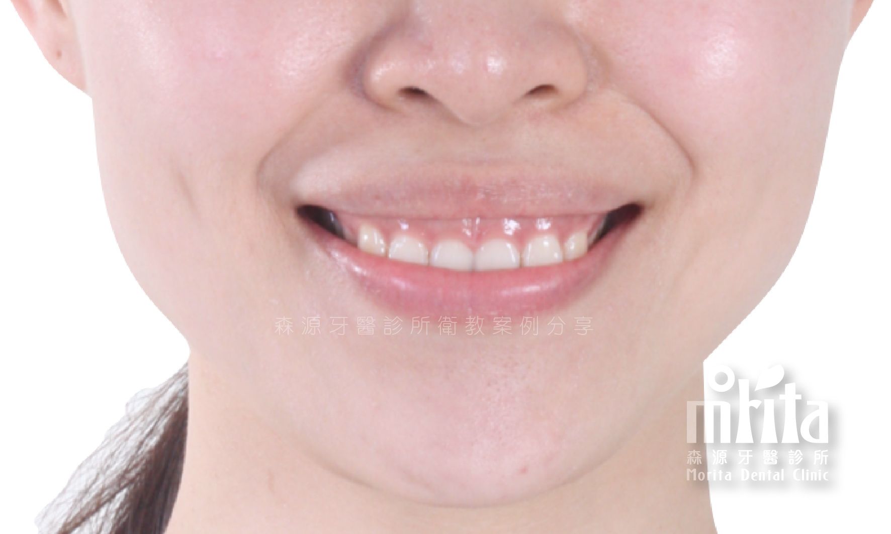 A close up of a woman 's face with a smile on her face.