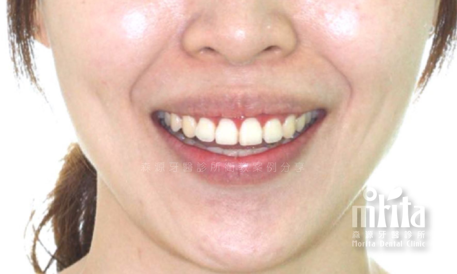A close up of a woman 's face with a smile on her face.