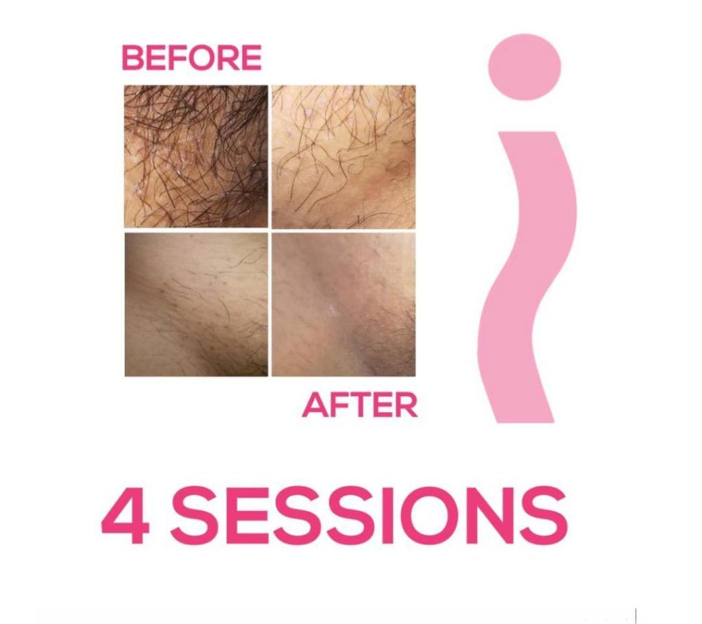 A before and after picture of a person 's hair