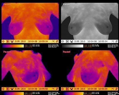 Medical ultrasound exam on a patient in a clinic, with a clinician using a probe on the neck. Medical ultrasound exam on a patient in a clinic, with a clinician using a probe on the neck.