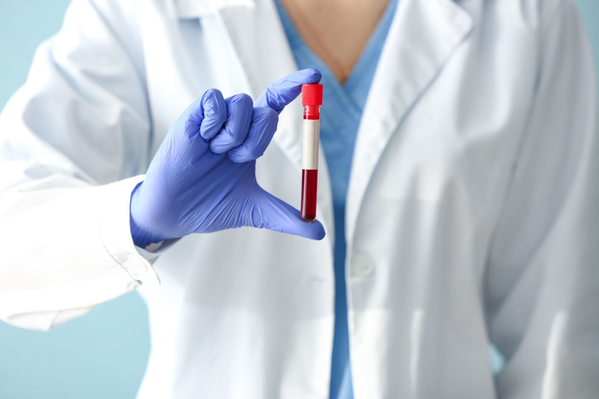 Gloved lab technician holding a red-capped blood sample tube in a white coat Gloved lab technician holding a red-capped blood sample tube in a white coat