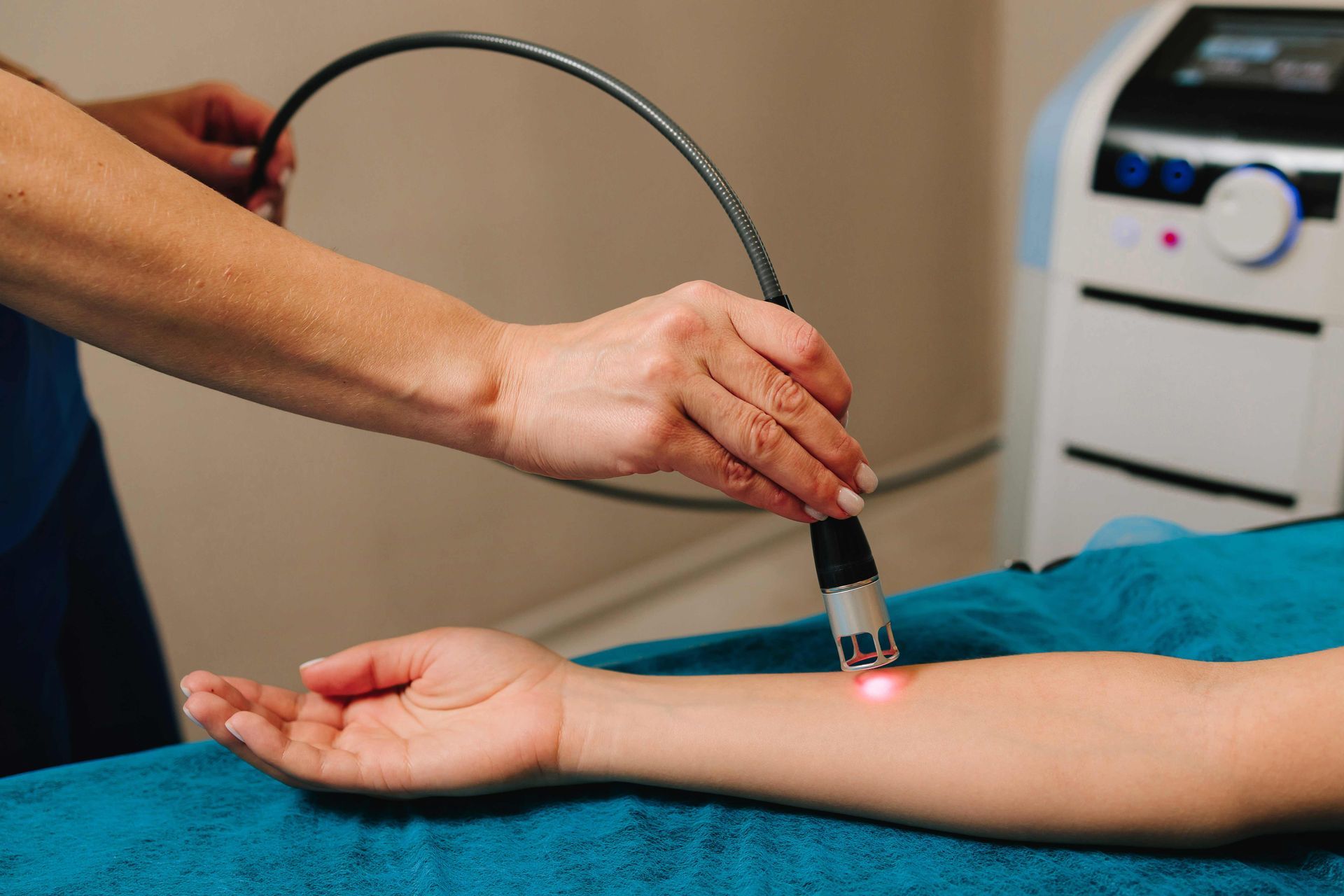 Handheld laser treatment on a patient’s forearm, with a red light on the skin.