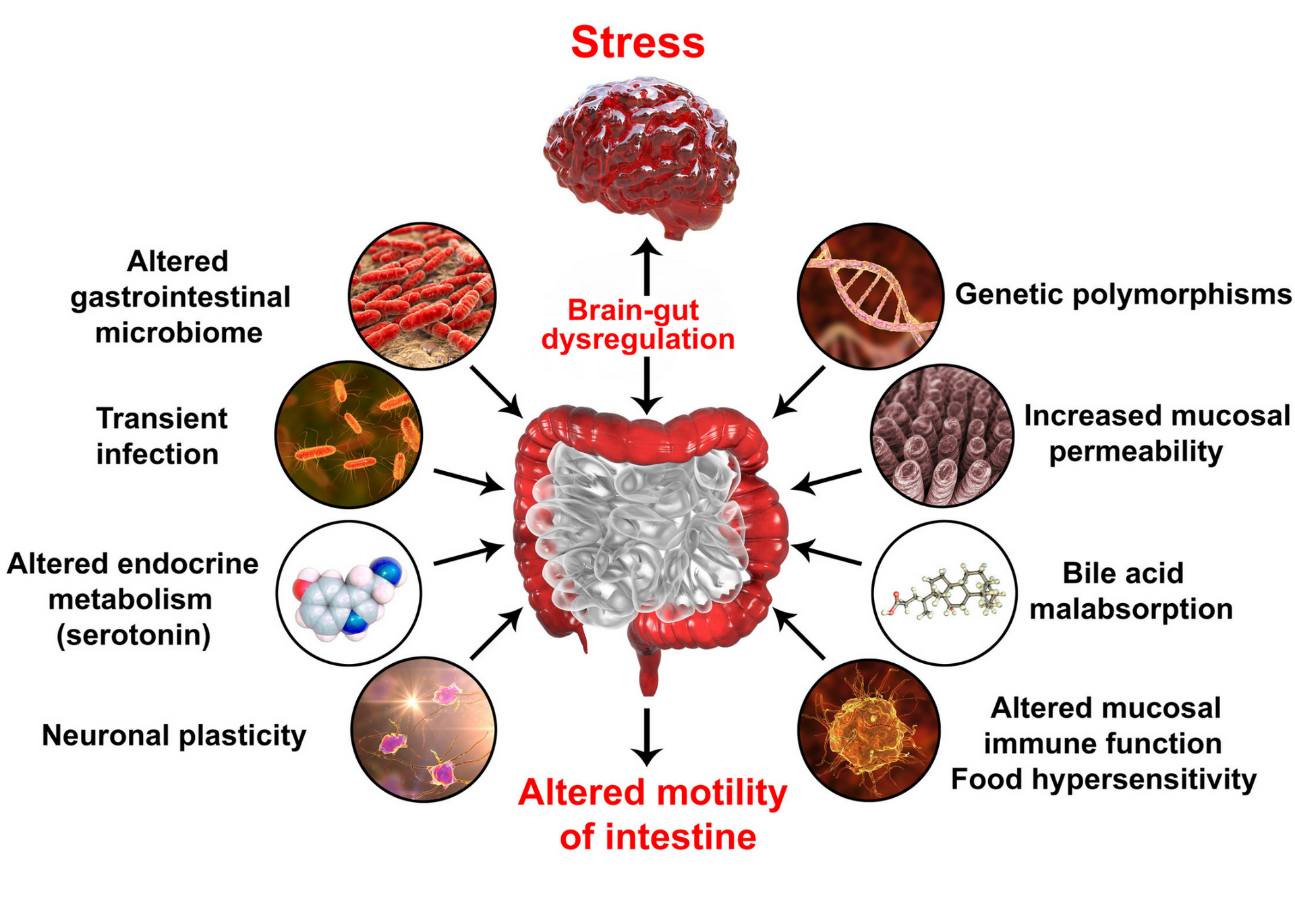 Diagram of stress-linked altered intestinal motility, with labeled factors around a central gut illustration.